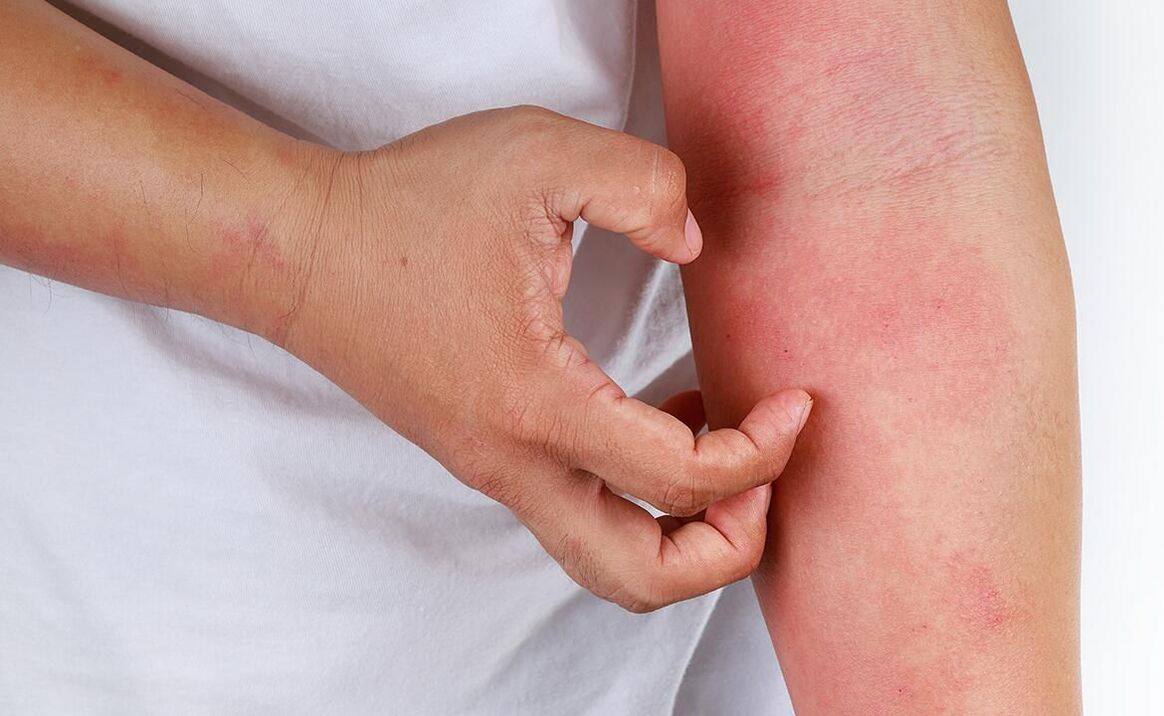 possible complications from the use of soft drinks