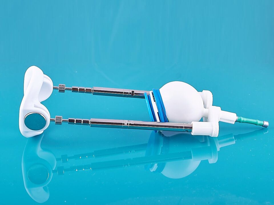 The extensor will help improve the outcome of the ligamentotomy.