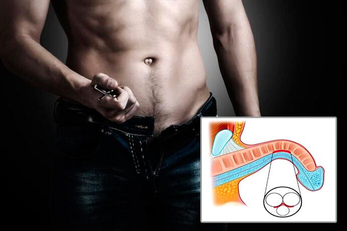 Man unbuttons his fly to do penis enlargement exercises